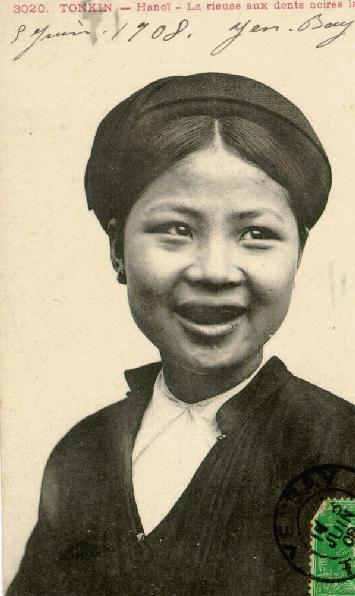 historic photo of blackened teeth