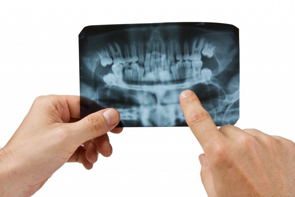 dentist pointing at xray