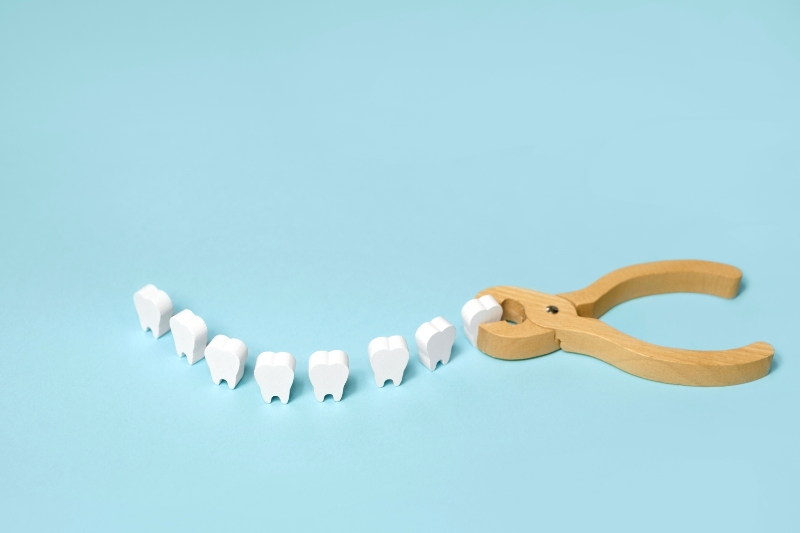 Wooden models of wisdom teeth and pilers on teal background in Tempe, AZ